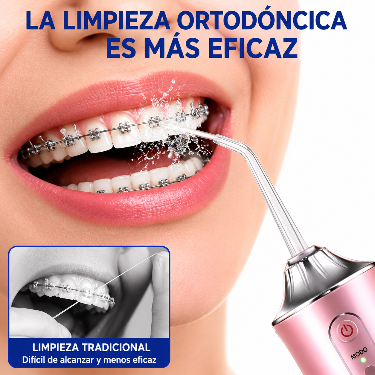 Irrigador Dental 360º | 4 Boquillas | Batería 1200 mAh | 10-15 Días | Stock Líder