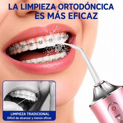 Irrigador Dental 360º | 4 Boquillas | Batería 1200 mAh | 10-15 Días | Stock Líder