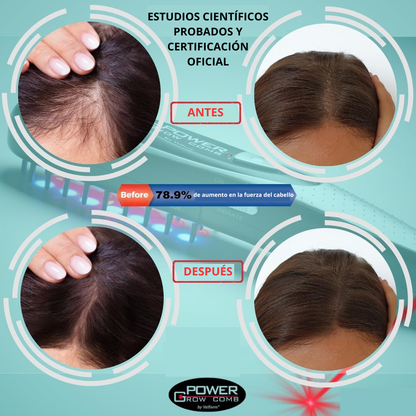 Velform Power Grow Comb | Peine Láser e Infrarrojos Para la Caída del Cabello
