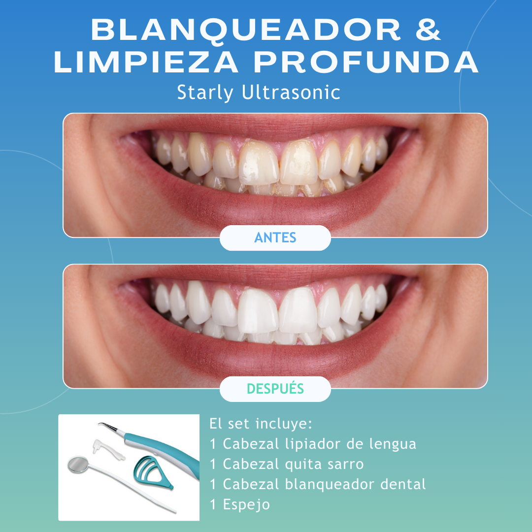 STARLYF Ultrasonic Dental Cleaner - 3000 Vibrations - 3 Brush Heads + LED Light