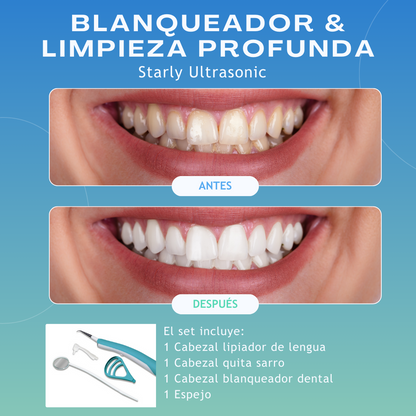 STARLYF Ultrasonic Dental Cleaner - 3000 Vibrations - 3 Brush Heads + LED Light