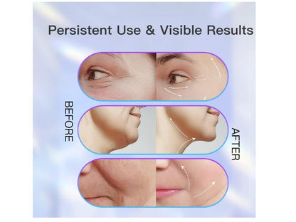 Facial Massager with 3 LED Lights and EMS - Deep Cleansing and Anti-Aging